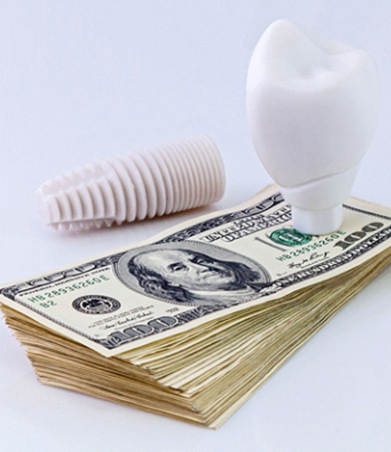 Dental implant on stack of $100 bills