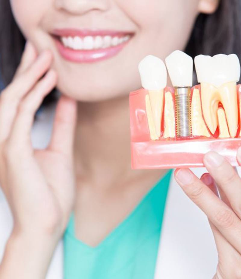 a dentist holding a model of dental implants