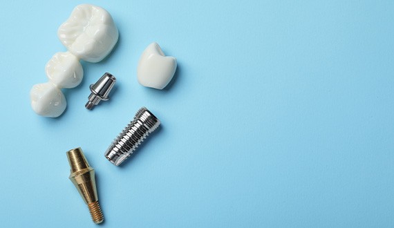 Dental implants and bridges are alternative methods of tooth replacement 